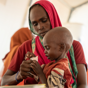 MSF: cibo terapeutico per la cura di 2 bambini malnutriti