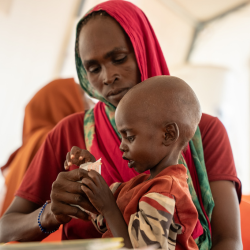 Artsen zonder Grenzen: Therapeutisch voedsel voor de verzorging van 2 ondervoede kinderen door AZG