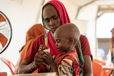 Médecins Sans Frontières : Aliments thérapeutiques pour la prise en charge de 2 enfants malnutris par MSF